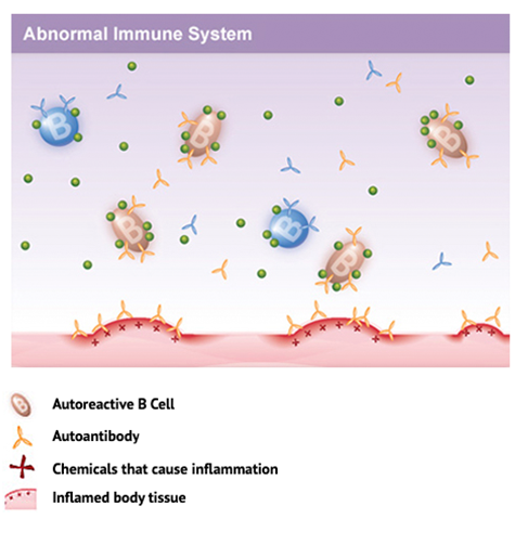 Diagram: abnormal Immune System