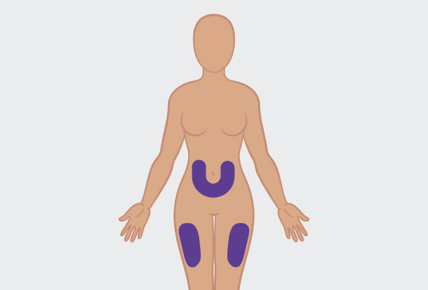 Choose an injection site (abdomen or thigh), as shown in the figure below: image-where-to-inject-benlysta